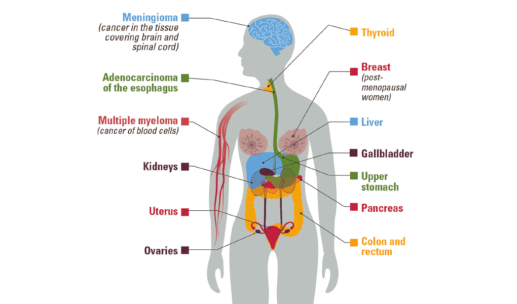 tipos-de-cancer